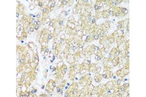 Immunohistochemistry of paraffin-embedded Human liver using ATP5I Polyclonal Antibody at dilution of 1:100 (40x lens). (ATP5I antibody)