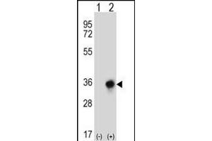 Western blot analysis of CBR3 (arrow) using rabbit polyclonal CBR3 Antibody (C-term) (ABIN656808 and ABIN2846022).