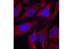 Immunofluorescence staining of methanol-fixed Hela cells using Phospho-SYN1-S9 antibody.