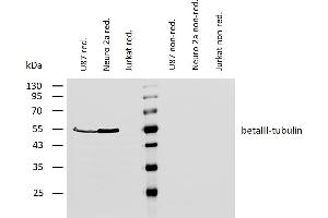 Western blotting analysis of human betaIII-tubulin using mouse monoclonal antibody TU-20 on lysates of U87 cells and Neuro 2a cells (and Jurkat cells as a negative control) under reducing and non-reducing conditions.