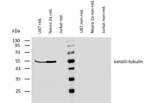 TUBB3 anticorps  (N-Term)