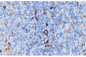 Immunohistochemistry of paraffin-embedded Rat spleen using MMP25 Polyclonal Antibody at dilution of 1:100 (40x lens). (MMP25 antibody)