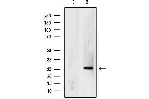 anti-Tumor Protein P53 Inducible Nuclear Protein 1 (TP53INP1) (Internal Region) antibody