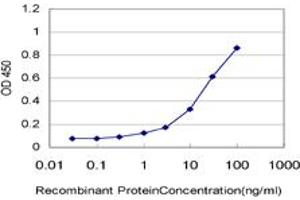 Detection limit for recombinant GST tagged USP21 is approximately 1ng/ml as a capture antibody. (USP21 antibody  (AA 466-565))