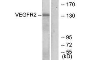 Western blot analysis of extracts from K562 cells, treated with LPS 100ng/ml 30', using VEGFR2 (Ab-1175) Antibody.