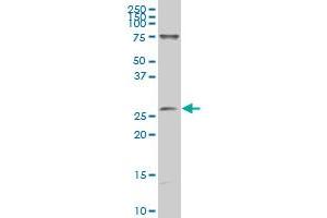 GATAD1 polyclonal antibody (A01), Lot # 051004JC01 Western Blot analysis of GATAD1 expression in Y-79 . (GATAD1 antibody  (AA 82-190))