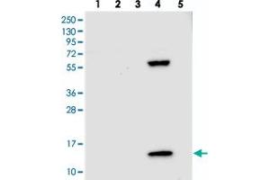 Western blot analysis of Lane 1: RT-4, Lane 2: U-251 MG, Lane 3: Human Plasma, Lane 4: Liver, Lane 5: Tonsil with PPP4R4 polyclonal antibody  at 1:250-1:500 dilution.