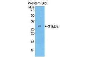 Western Blotting (WB) image for anti-Pitrilysin Metallopeptidase 1 (PITRM1) (AA 544-806) antibody (ABIN1859866) (PITRM1 antibody  (AA 544-806))