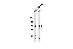 All lanes : Anti-AXIN1 Antibody (C-term) at 1:1000 dilution Lane 1: MDA-MB-453 whole cell lysate Lane 2: Raji whole cell lysate Lysates/proteins at 20 μg per lane.