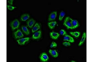 Immunofluorescent analysis of A549 cells using ABIN7161482 at dilution of 1:100 and Alexa Fluor 488-congugated AffiniPure Goat Anti-Rabbit IgG(H+L) (SLC3A1 antibody  (AA 1-68))