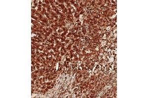 Immunohistochemistry (Paraffin-embedded Sections) (IHC (p)) image for anti-Cathepsin D (CTSD) (AA 1-412) antibody (ABIN6242215)