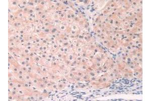 Immunohistochemistry (IHC) image for anti-Fibronectin (AA 313-607) antibody (ABIN1077665)