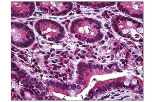Human Small Intestine: Formalin-Fixed, Paraffin-Embedded (FFPE) (MCL-1 antibody  (AA 121-139))