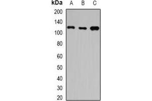 Western blot analysis of HIP1 expression in A549 (A), SW480 (B), mouse brain (C) whole cell lysates. (HIP1 antibody)