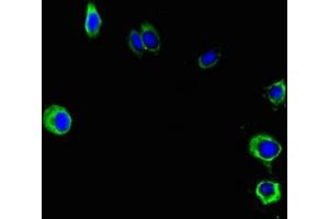 Immunofluorescent analysis of Hela cells using ABIN7162692 at dilution of 1:100 and Alexa Fluor 488-congugated AffiniPure Goat Anti-Rabbit IgG(H+L) (PNPLA2 antibody  (AA 1-504))