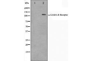 Western blot analysis on HeLa cell lysate using GABBR1 Antibody,The lane on the left is treated with the antigen-specific peptide. (GABBR1 antibody  (C-Term))