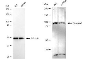 Western blotting analysis using Nesprin3 antibody (ABIN7798074). (Recombinant Nesprin3 antibody)