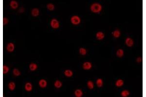 Immunofluorescence (fixed cells) (IF/ICC) image for anti-Minichromosome Maintenance Complex Component 5 (MCM5) (N-Term) antibody (ABIN6263163)