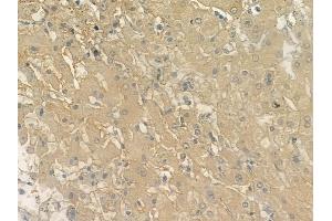 ABIN6262980 and ABIN6272946 at 1/100 staining human normal liver tissue by IHC-P.