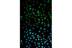 Immunofluorescence analysis of MCF7 cell using STK11 antibody. (LKB1 antibody  (AA 134-433))