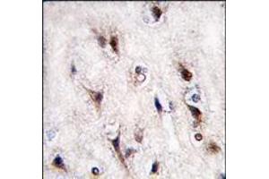 Formalin-fixed and paraffin-embedded human brain tissue reacted with NURR1 (NR4A2) antibody (N-term), which was peroxidase-conjugated to the secondary antibody, followed by DAB staining. (NR4A2 antibody  (N-Term))