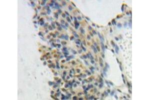 #VALUE! (GTF2E1 antibody  (AA 15-306))