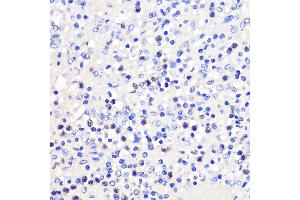 Immunohistochemistry of paraffin-embedded Human spleen using 4-1BB/CD137 Rabbit pAb (ABIN7271073) at dilution of 1:100 (40x lens). (CD137 antibody  (AA 150-250))