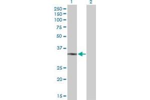Western Blot analysis of UCP2 expression in transfected 293T cell line by UCP2 MaxPab polyclonal antibody. (UCP2 antibody  (AA 1-309))