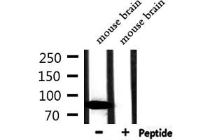 Western blot analysis of extracts from mouse brain, using CFB Antibody. (Complement Factor B antibody  (Internal Region))