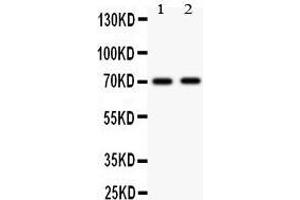 Anti-MEKK3 antibody, Western blotting All lanes: Anti MAP3K3  at 0.