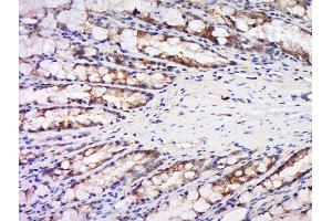 Immunohistochemistry (Paraffin-embedded Sections) (IHC (p)) image for anti-serpin Peptidase Inhibitor, Clade B (Ovalbumin), Member 5 (SERPINB5) (AA 301-375) antibody (ABIN728233)