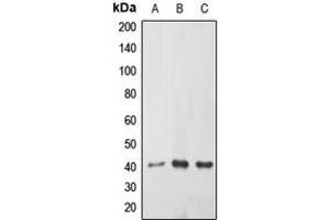 Western blot analysis of ABHD9 expression in HEK239T (A), mouse kidney (B), rat kidney (C) whole cell lysates. (ABHD9 antibody  (Center))