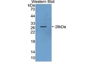 Detection of Recombinant KPNa3, Human using Polyclonal Antibody to Karyopherin Alpha 3 (KPNa3)