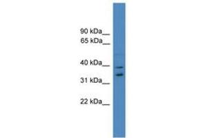 Image no. 1 for anti-Ubiquitin Fusion Degradation Protein 1 Homolog (UFD1L) (AA 161-210) antibody (ABIN6745307) (UFD1L antibody  (AA 161-210))