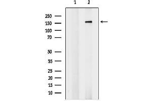 Western blot analysis of lysates from H2O2 treated EC304 cells, using Phospho-ROCK2 (Tyr722) Antibody.