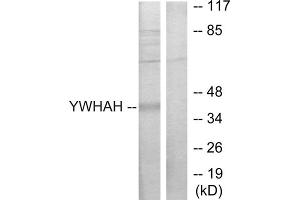 Western blot analysis of extracts from Jurkat cells, using 14-3-3 eta antibody. (14-3-3 eta antibody  (Internal Region))