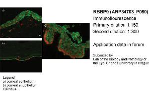 Image no. 2 for anti-Retinoblastoma Binding Protein 9 (RBBP9) (N-Term) antibody (ABIN2775962) (RBBP9 antibody  (N-Term))