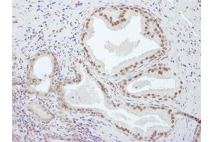 anti-Phosphate Cytidylyltransferase 1, Choline, alpha (PCYT1A) (AA 1-50) antibody