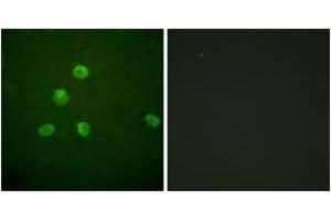 Immunofluorescence (IF) image for anti-FBJ Murine Osteosarcoma Viral Oncogene Homolog B (FOSB) (AA 12-61) antibody (ABIN2888837) (FOSB antibody  (AA 12-61))