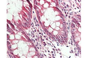 Anti-RRAGA antibody IHC staining of human colon. (RRAGA antibody  (HRP))