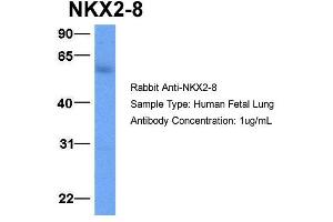Host:  Rabbit  Target Name:  NKX2-8  Sample Type:  Human Fetal Lung  Antibody Dilution:  1. (NKX2-8 antibody  (C-Term))