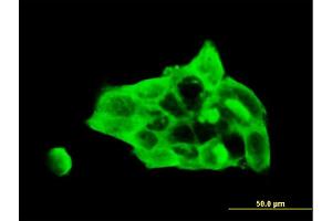 Immunofluorescence of monoclonal antibody to DSC3 on A-431 cell. (Desmocollin 3 antibody  (AA 585-684))