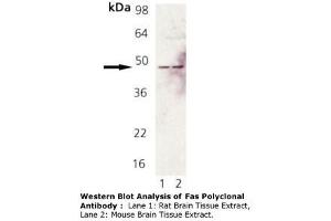 Image no. 1 for anti-TNF Receptor Superfamily, Member 6 (FAS) antibody (ABIN465927) (FAS antibody)