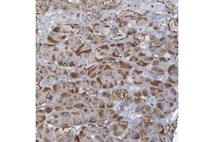 Immunohistochemical staining of human adrenal gland with C3orf18 polyclonal antibody  shows strong cytoplasmic positivity in cortical cells at 1:50-1:200 dilution. (C3orf18 antibody)