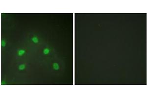 Immunofluorescence analysis of HeLa cells, using hnRNP L antibody. (HNRNPL antibody  (Internal Region))