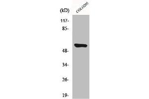 Western Blot analysis of HeLa cells using CYP4A11/22 Polyclonal Antibody (CYP4A11/CYP4A22 (Internal Region) antibody)