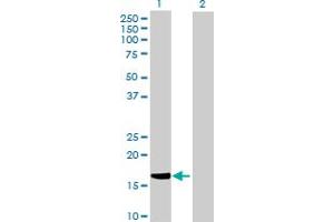 Western Blot analysis of HSPB7 expression in transfected 293T cell line by HSPB7 MaxPab polyclonal antibody. (HSPB7 antibody  (AA 1-170))