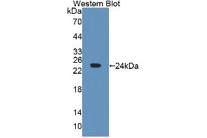 Figure. (CHN2 antibody  (AA 101-280))