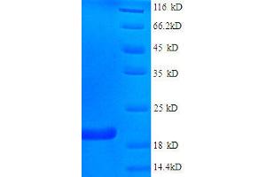 Fragile Histidine Triad (FHIT) (AA 2-147), (full length) protein (His tag) (FHIT Protein (AA 2-147, full length) (His tag))