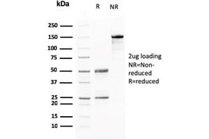 SDS-PAGE Analysis Purified AKT1 Mouse Monoclonal Antibody (AKT1/2784). (BARX1 antibody)